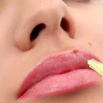 Ботулінотерапія
                    Студія татуажу Школа-студия Татьяны Поливановой Одеса