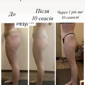 Ельнара Барская, Кропивницкий Фото - 5