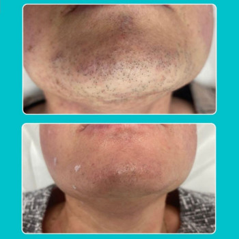 EPILOOK, Одесса Фото - 5