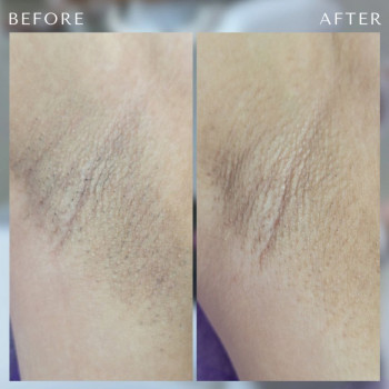 IRIS, Одеса Фото - 5