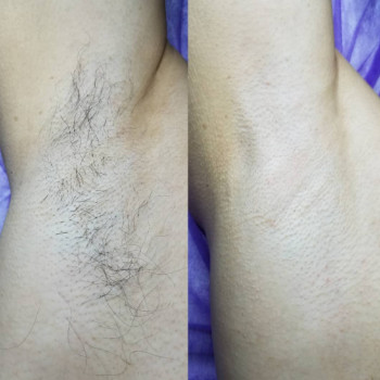 Анна Чаплигіна, Запоріжжя Фото - 5