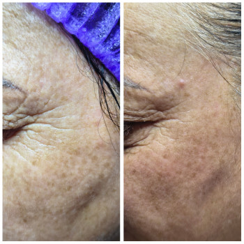 Людмила Патек, Ужгород Фото - 4