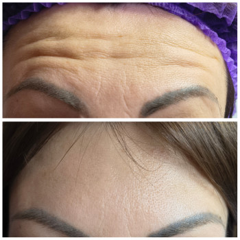 Людмила Патек, Ужгород Фото - 3