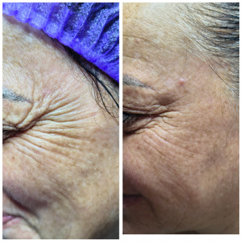 Людмила Патек, Ужгород Фото - 22