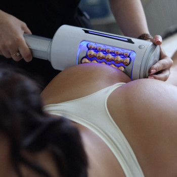 LASE EPIL, Одесса Фото - 5