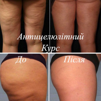 Arkadia massage, Одеса Фото - 5