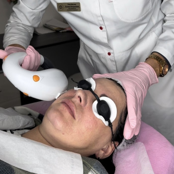 Сучасне лікування акне, куперозу, пігментації. Дає ефект фот