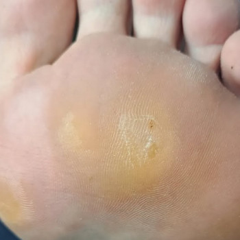 Татьяна Пинаева, Кропивницкий Фото - 5