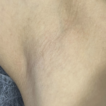 Laser Impulse, Тернополь Фото - 11