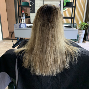 Ботокс
                    Трихолог Марина Софіївська Борщагівка