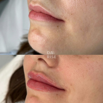 Дар'я Чумак, Миколаїв Фото - 5