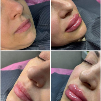 Виктория Рибалко, Николаев Фото - 5