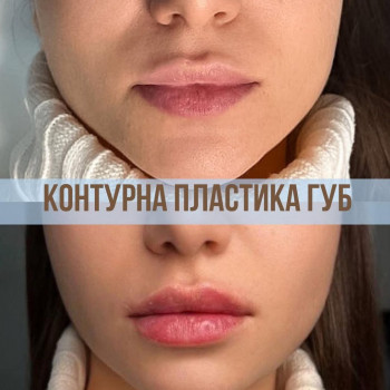 Вікторія Дегтяр, Миколаїв Фото - 1