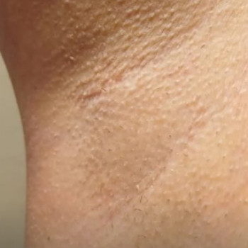 Олеся Пидбицкая, Кропивницкий Фото - 5