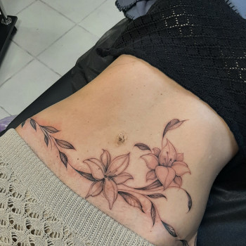 Перекриття шраму