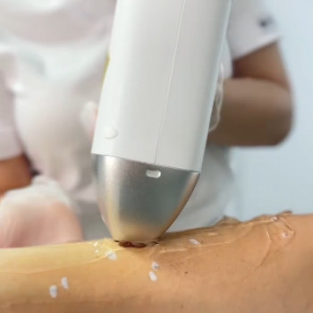 Epil Spa, Кропивницкий Фото - 5