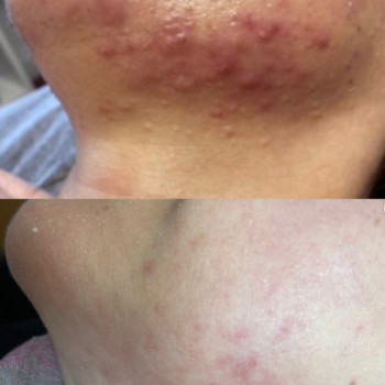 Алла Бойко, Кропивницький Фото - 5