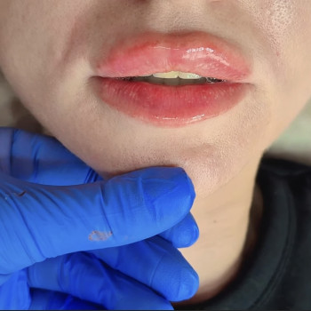 Фото из портфолио косметолога Любовь Черней (Запорожье)