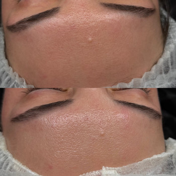 Христина Українська, Буча Фото - 25