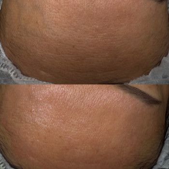 Христина Українська, Буча Фото - 28