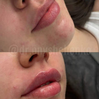 MAVKA, Полтава Фото - 6