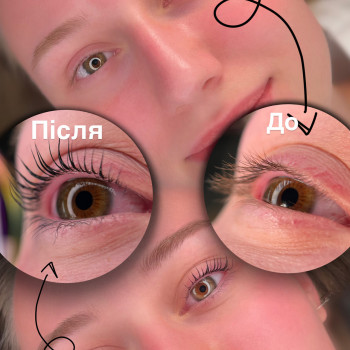 Ламінування вій
                    Бровист  Буча