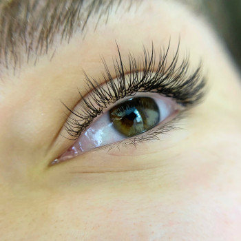 Класичне нарощування з промінцями