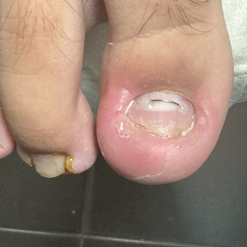   ніготь  системи #