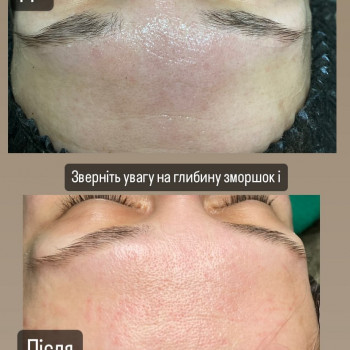 Інна Голубенко, Полтава Фото - 1