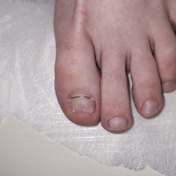 Фото з портфоліо фахівця Дарина Сергієнко (подолог, Черкаси)