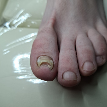 Фото з портфоліо фахівця Дарина Сергієнко (подолог, Черкаси)