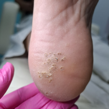 Фото з портфоліо фахівця Дарина Сергієнко (подолог, Черкаси)