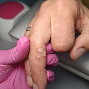 Фото з портфоліо фахівця Дарина Сергієнко (подолог, Черкаси)