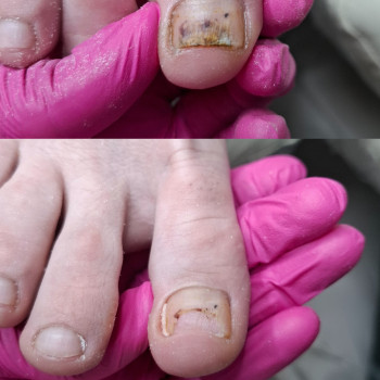 Фото з портфоліо фахівця Дарина Сергієнко (подолог, Черкаси)