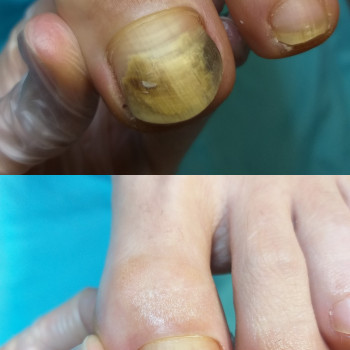 Фото з портфоліо фахівця Дарина Сергієнко (подолог, Черкаси)