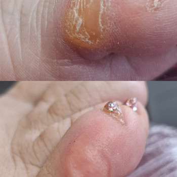 Фото з портфоліо фахівця Дарина Сергієнко (подолог, Черкаси)