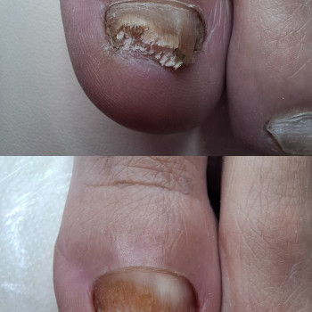 Фото з портфоліо фахівця Дарина Сергієнко (подолог, Черкаси)