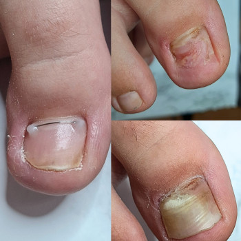 Фото з портфоліо фахівця Дарина Сергієнко (подолог, Черкаси)