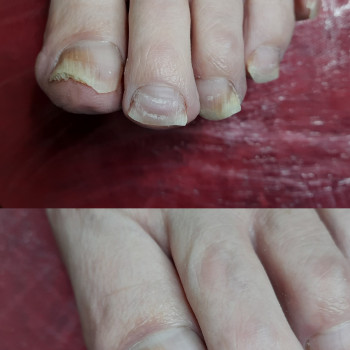 Фото з портфоліо фахівця Дарина Сергієнко (подолог, Черкаси)