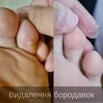 Фото з портфоліо фахівця Дарина Сергієнко (подолог, Черкаси)