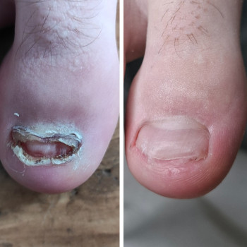 Фото з портфоліо фахівця Дарина Сергієнко (подолог, Черкаси)