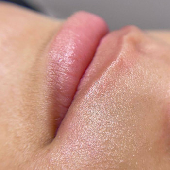 Воскова депіляція вусиків