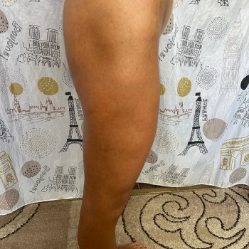 Масаж антицелюлітний
                    Реабілітолог Юлия Київ