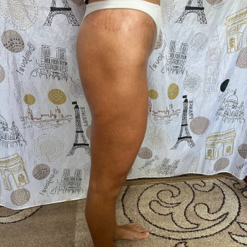 Масаж антицелюлітний
                    Реабілітолог Юлия Київ