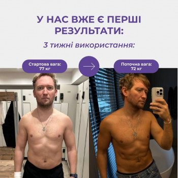 Біопатид,лікування ожиріння та надмірної ваги
                    Салон краси Atmosfera Krasu Чернівці