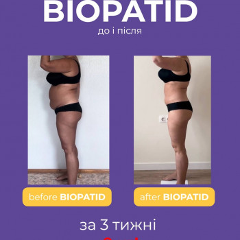 Біопатид,лікування ожиріння та надмірної ваги
                    Салон краси Atmosfera Krasu Чернівці