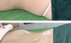 Lipokiller Масажист Елена Одеса