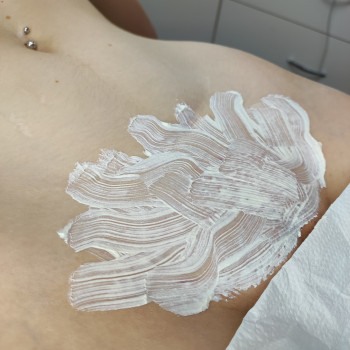 Депіляція глибокого бікіні.
Як що в тебе є проблеми з висипаннями на бікіні я тобі в цьому допоможу...