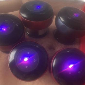 Вакуумний масаж банками з інфрочервоним прогрівом та масаж бамбуковими банками
                    Массажист  Одесса