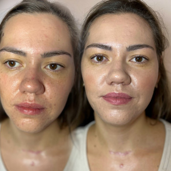 Наталя Микитин, Івано-Франківськ Фото - 17